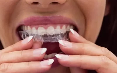 Invisalign Oxnard: Clear Aligner Therapy for Discreet Orthodontic Correction